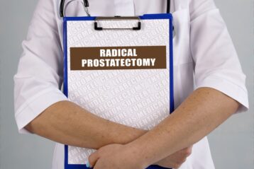 prostatektomia radykalna